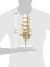 Cargar imagen en el visor de la galería, Columna vertebral lumbar A76/5 con disco intervertebral prolapsado dorso-Lateral, altura de 13.4&quot;
