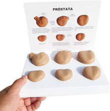 Cargar imagen en el visor de la galería, Modelo Anatómico Masculino de Próstata: Anatomía Normal y Patológica