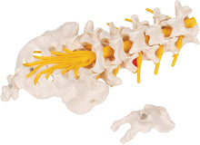 Cargar imagen en el visor de la galería, Columna vertebral lumbar A76/5 con disco intervertebral prolapsado dorso-Lateral, altura de 13.4&quot;