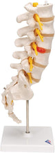 Cargar imagen en el visor de la galería, Columna vertebral lumbar A76/5 con disco intervertebral prolapsado dorso-Lateral, altura de 13.4&quot;