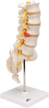 Cargar imagen en el visor de la galería, Columna vertebral lumbar A76/5 con disco intervertebral prolapsado dorso-Lateral, altura de 13.4&quot;