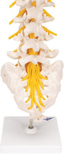 Cargar imagen en el visor de la galería, Columna vertebral lumbar A76/5 con disco intervertebral prolapsado dorso-Lateral, altura de 13.4&quot;
