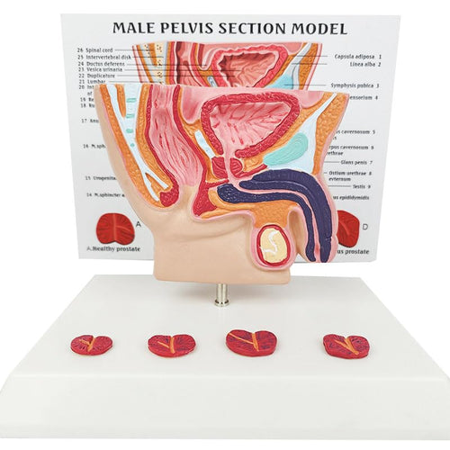 Modelo de próstata masculino humano y vejiga abdominal