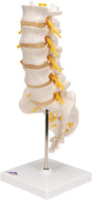 Cargar imagen en el visor de la galería, Columna vertebral lumbar A76/5 con disco intervertebral prolapsado dorso-Lateral, altura de 13.4&quot;