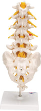 Cargar imagen en el visor de la galería, Columna vertebral lumbar A76/5 con disco intervertebral prolapsado dorso-Lateral, altura de 13.4&quot;