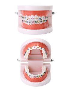 Modelo anatómico de dentadura con de demostración de ortodoncia