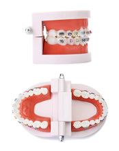 Cargar imagen en el visor de la galería, Modelo anatómico de dentadura con de demostración de ortodoncia