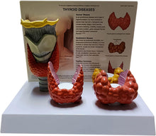 Cargar imagen en el visor de la galería, modelo de anatomía y patología tiroidea