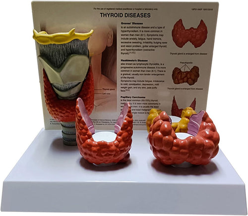 modelo de anatomía y patología tiroidea