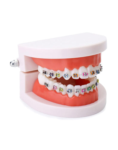 Modelo anatómico de dentadura con de demostración de ortodoncia