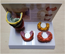 Cargar imagen en el visor de la galería, modelo de anatomía y patología tiroidea