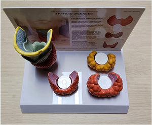 modelo de anatomía y patología tiroidea
