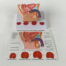Cargar imagen en el visor de la galería, Modelo de próstata masculino humano y vejiga abdominal