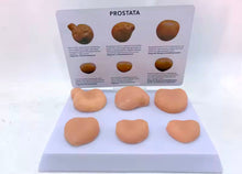 Cargar imagen en el visor de la galería, Modelo Anatómico Masculino de Próstata: Anatomía Normal y Patológica