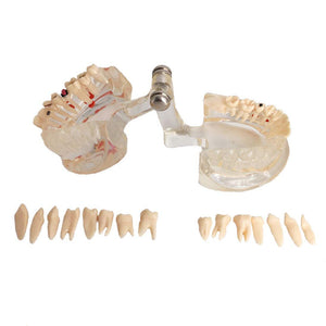 Modelo de implante dental y reparación neutra para demostraciones de enseñanza de dentistas.