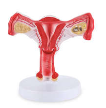 Cargar imagen en el visor de la galería, Modelo de Útero y Ovario Humano
